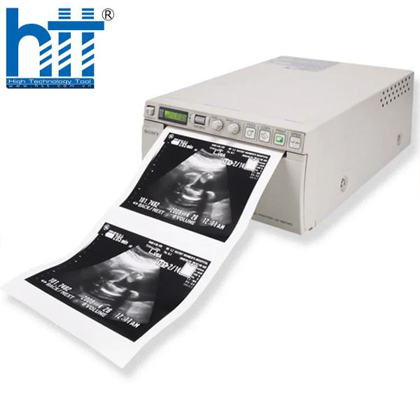 Giấy in kết quả siêu âm đen trắng UPP-110S – Lựa chọn hàng đầu cho máy Sony.